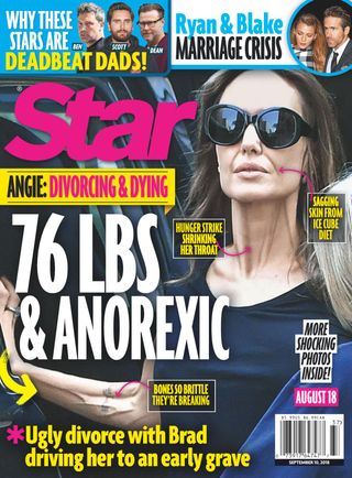 Star
