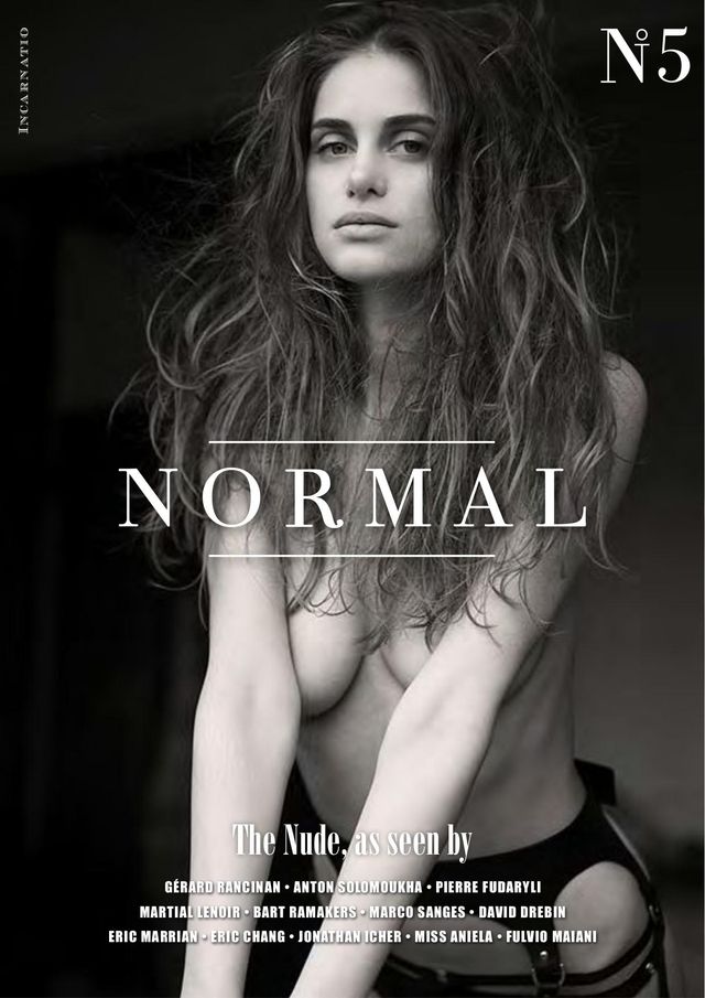Normal